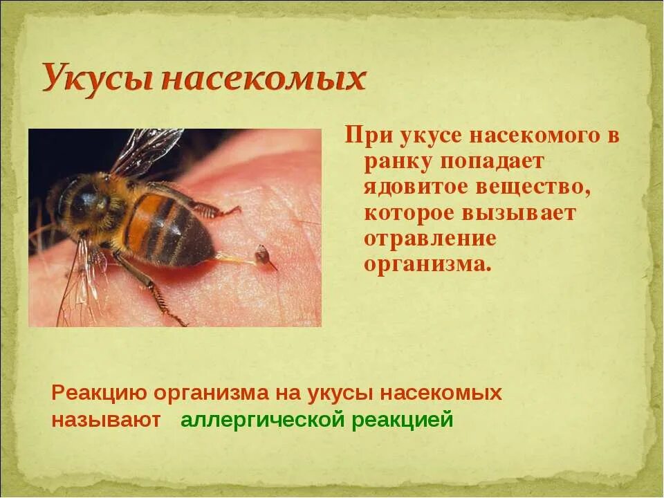 Помощь при укусе осы. Укусы ядовитых насекомых. Оказание ПМП при укусе насекомых.