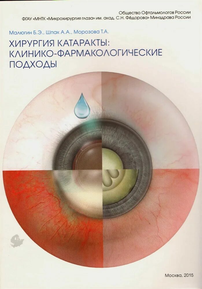 Катаракта клинические рекомендации. Книга по офтальмологии катаракта. Катаракта рекомендации.