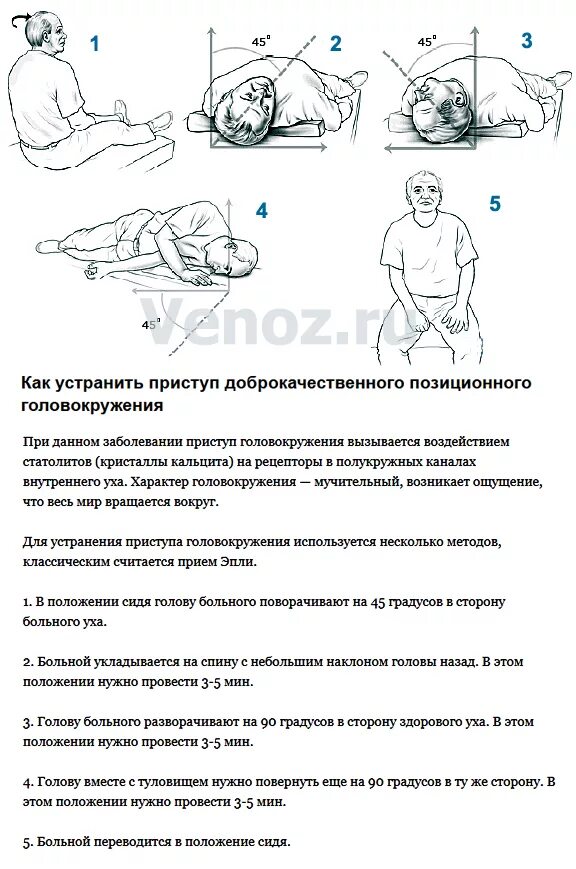 Головокружение при вставании и когда. Упражнения приголовокружнии. Упражнения при пароксизмальном головокружении. Доброкачественное позиционное головокружение гимнастика. Головокружение при повороте головы.