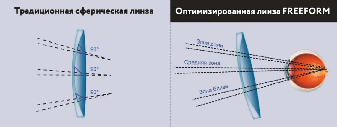 Стандартные линзы. Очковые линзы Freeform. Freeform линзы для очков. Технология линз очков Freeform. Оптимизированные и индивидуальные линзы.