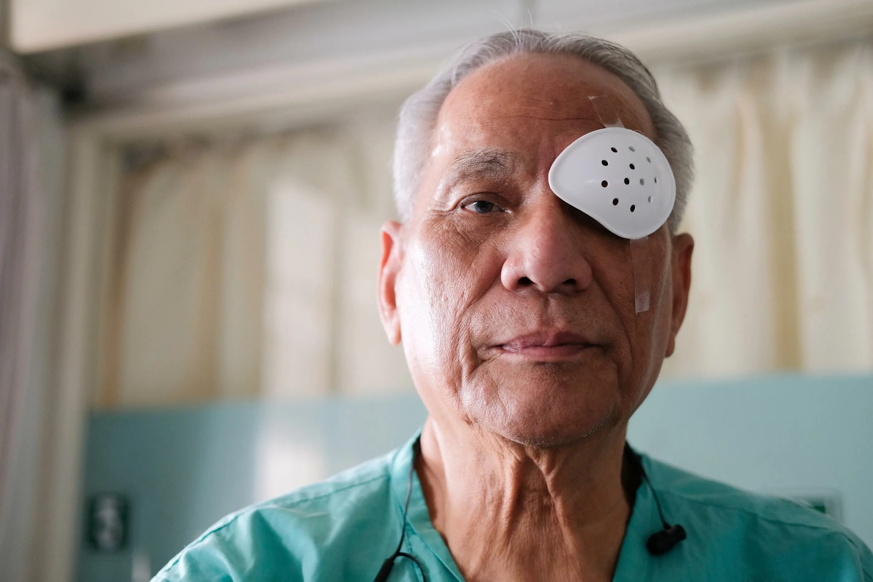Катаракта операция после 70 лет. Фото старушки после операции на глаза. Ведение больных после операции по удалению катаракты 86 лет. Операция катаракты у пожилых людей цена. Лечение катаракты у пожилых людей операция