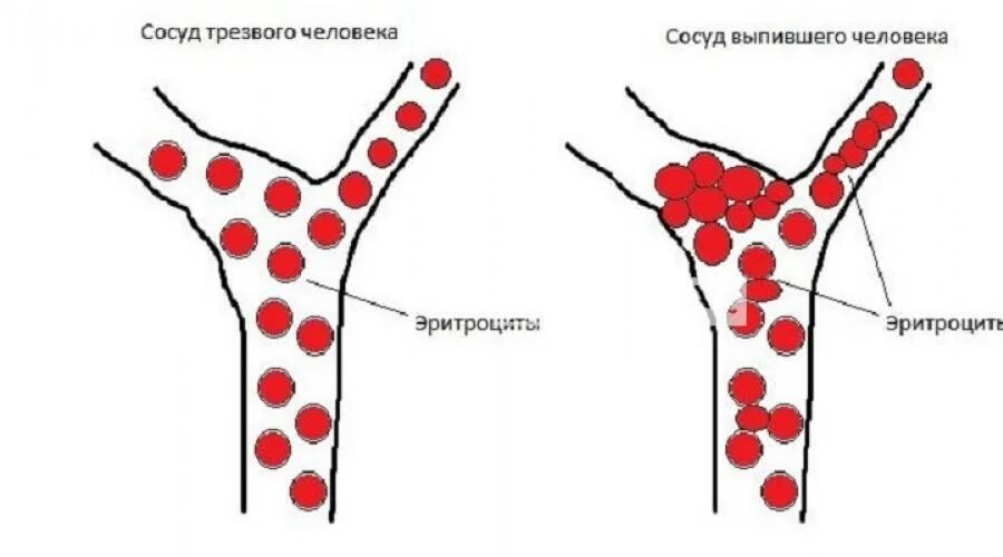 Кровь не сворачивается болезнь. Как сворачивается кровь.