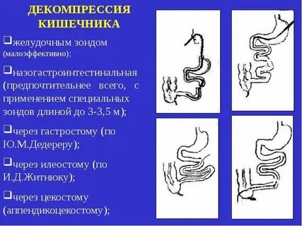 Декомпрессия это