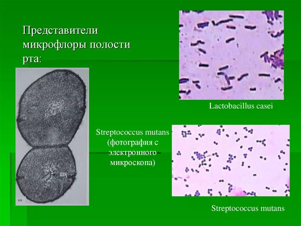 Микрофлора ротовой полости. Микрофлора полости рта микробиология. представители резидентной микрофлоры полости рта. представители нормальной микрофлоры ротовой полости. патогенная микрофлора полости рта представители.