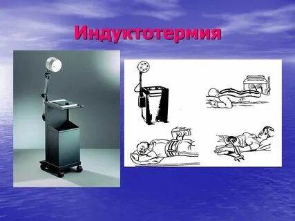 Индуктотермия