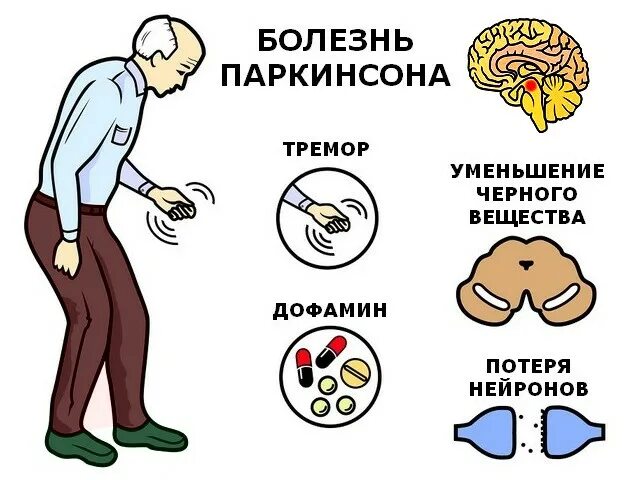 Болезнь Паркинсона. Болезнь паркинсонизм. Симптомы Паркинсона. Болезнь Паркинсона памятка.