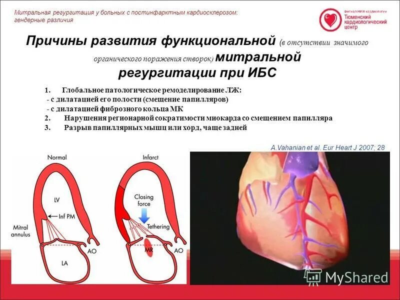 Регургитацией называется