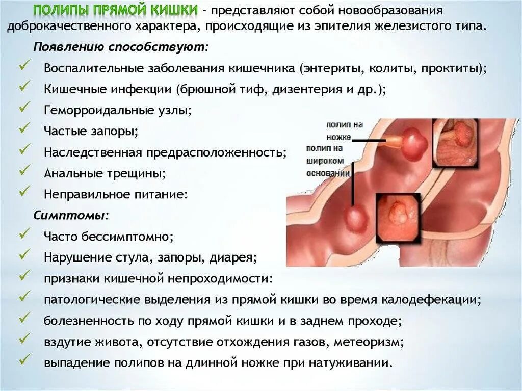 Полипы толстой кишки осложнения. Полипы прямой кишки и полипоз. Тип полипа прямой кишки.