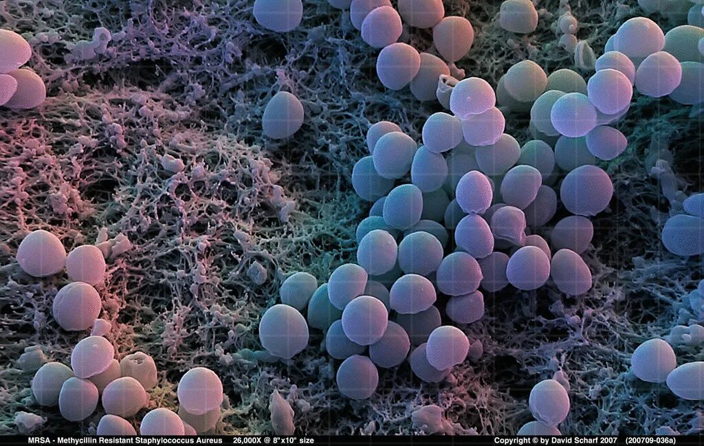 Prsa стафилококки. MRSA И MRSE стафилококки. 1 staphylococcus aureus