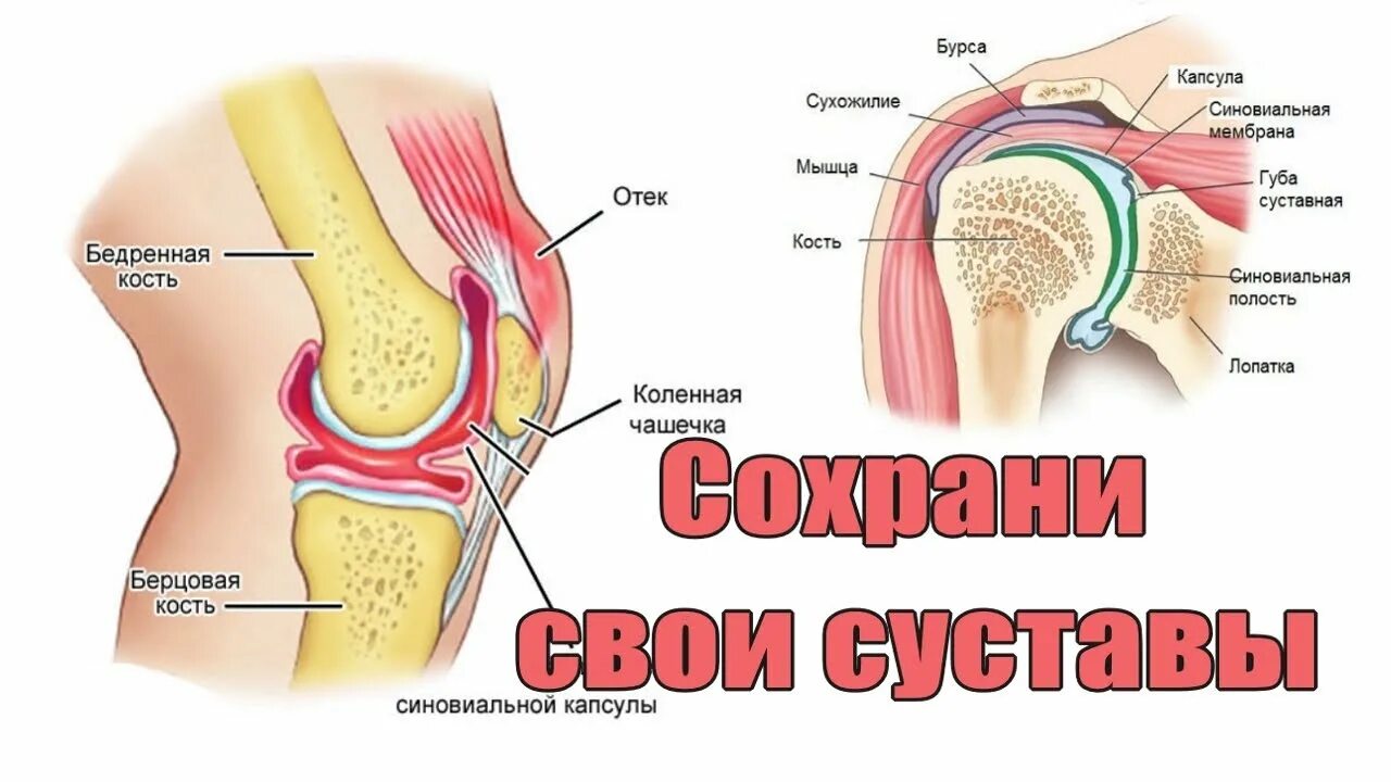 Почему болят все суставы одновременно