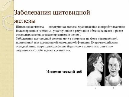 Заболевания связанные с железом