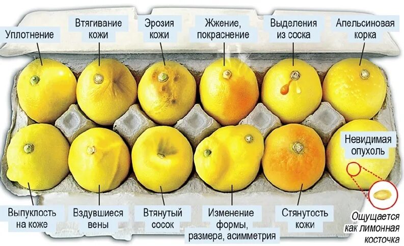 Как выглядит рак молочной железы Why is the incidence of breast cancer increasing YouTube