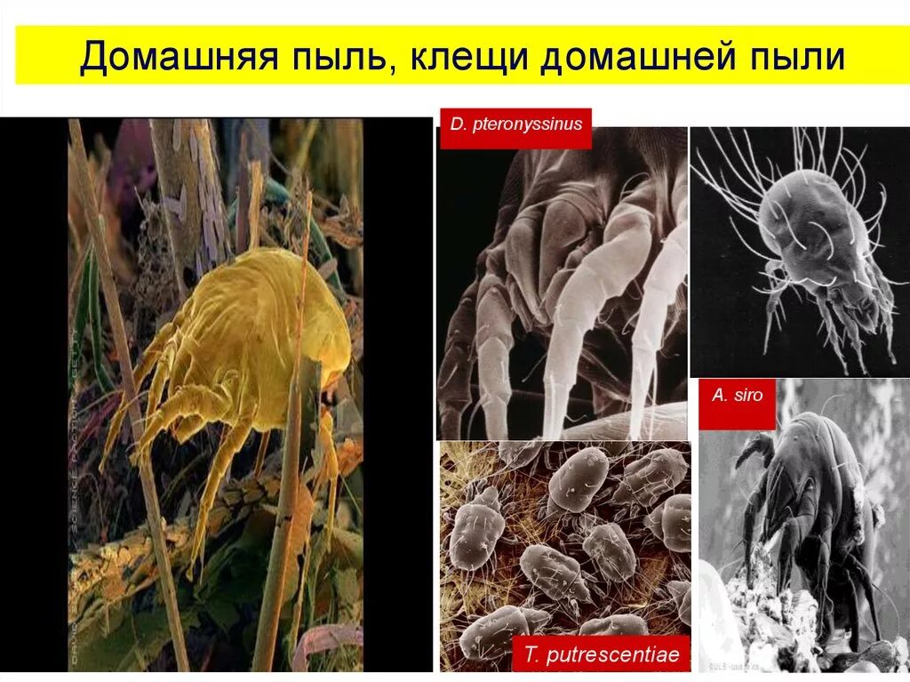 Состав пыли. Домашняя пыль. клещи домашней пыли. состав домашней пыли. исследование домашней пыли.