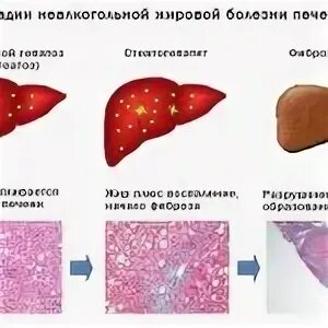 Печень после приема антибиотиков