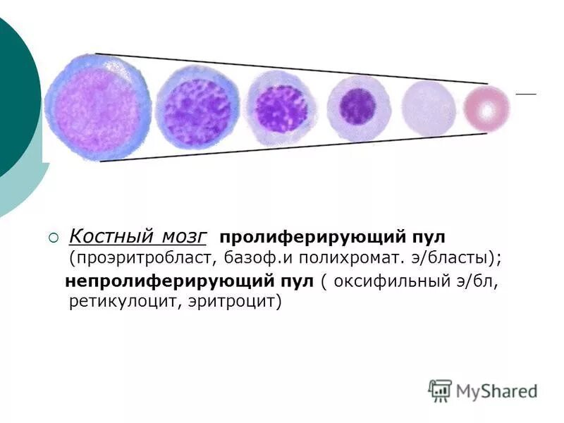 бласты в костном мозге. бласты морфология. морфология бластных клеток. бластные клетки в крови микроскопия. гипогранулярный вариант острый промиелоцитарный лейкоз.