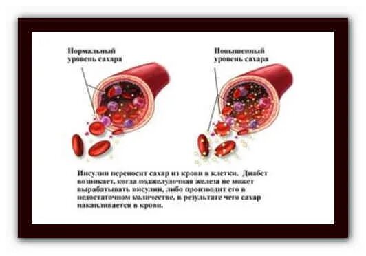 Холестерин и глюкоза