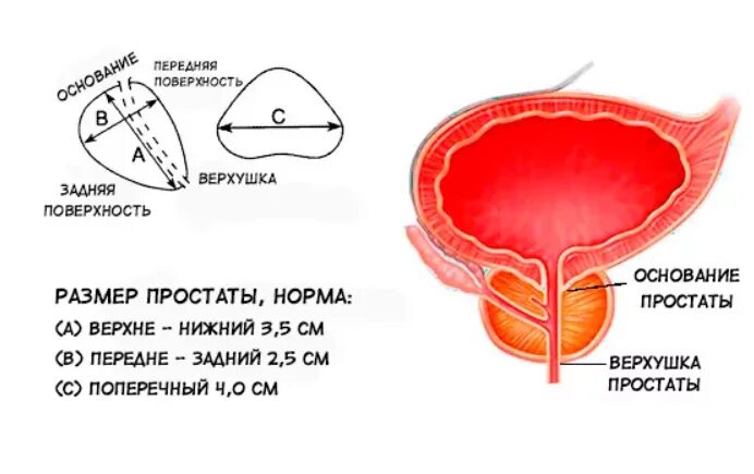 Какие нормальные размеры предстательной железы. Размеры предстательной железы в норме. размеры простаты норма по возрастам. объем предстательной железы в норме. объем предстательной железы у мужчин в норме в норме.