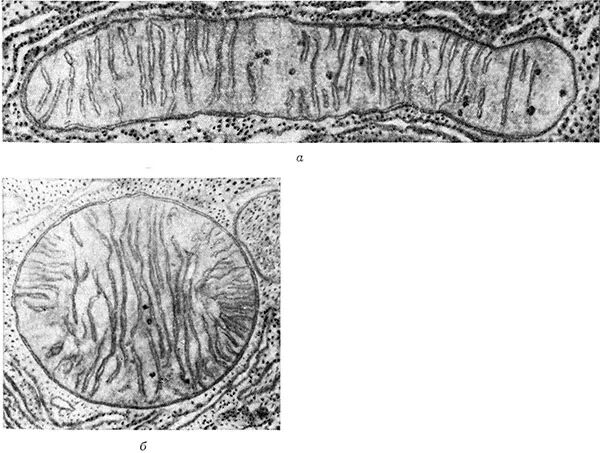 Митохондрии в клетках печени. Митохондрии гистология. Митохондрии в эпителиальных клетках кишечника аскариды. Хондриосомы в эпителиальных клетках кишечника аскариды. Электронограмма митохондрии.