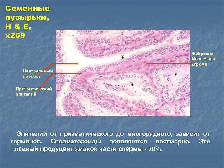 Строма плотная. Строма плотная