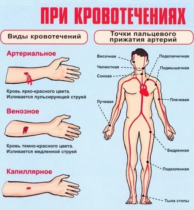 Кровотечения бывают следующих видов ответ. Как Остановить кровотечение. Как остановитьткровотечение. Артериальное кровотечение. Артериальное и венозное кровотечение.