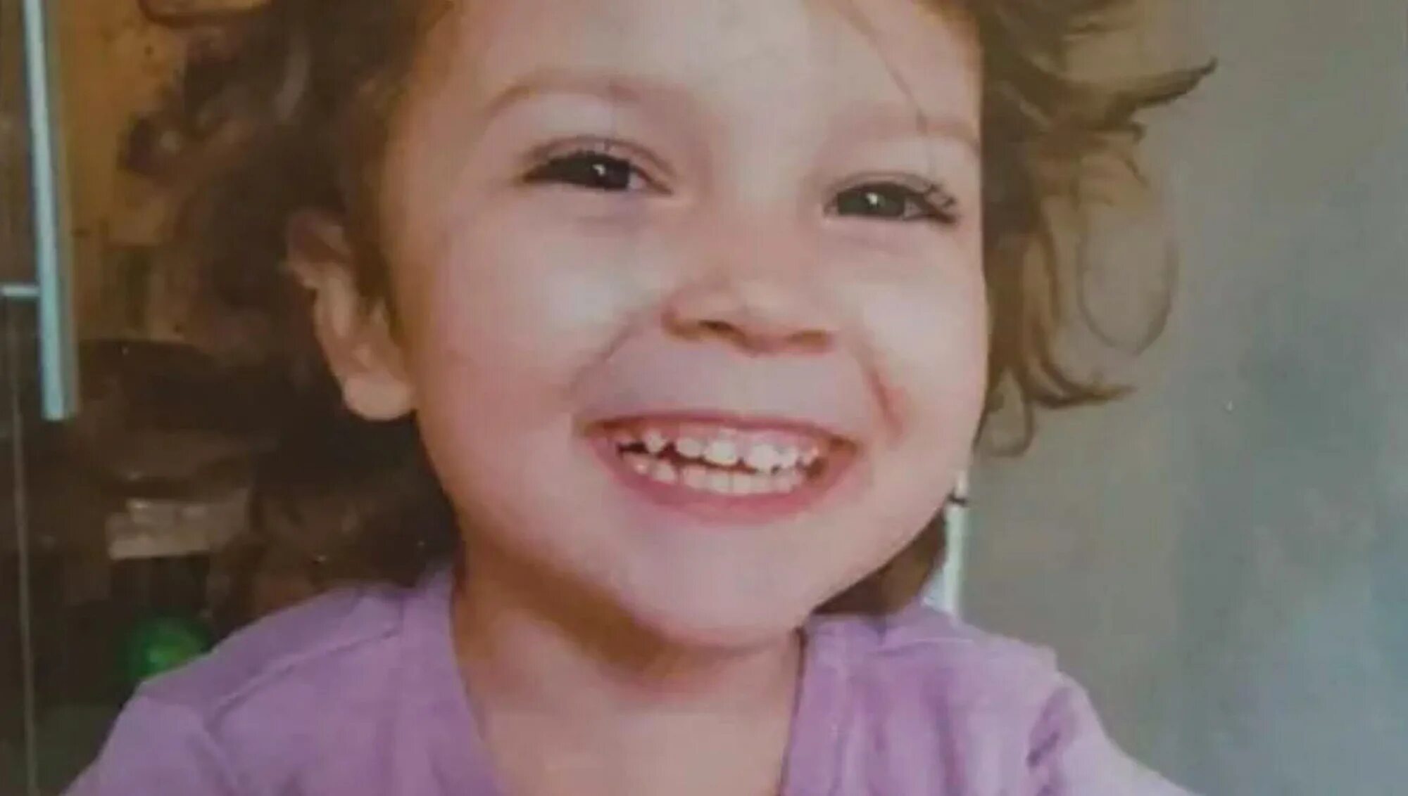 Девочка умерла на приеме у стоматолога