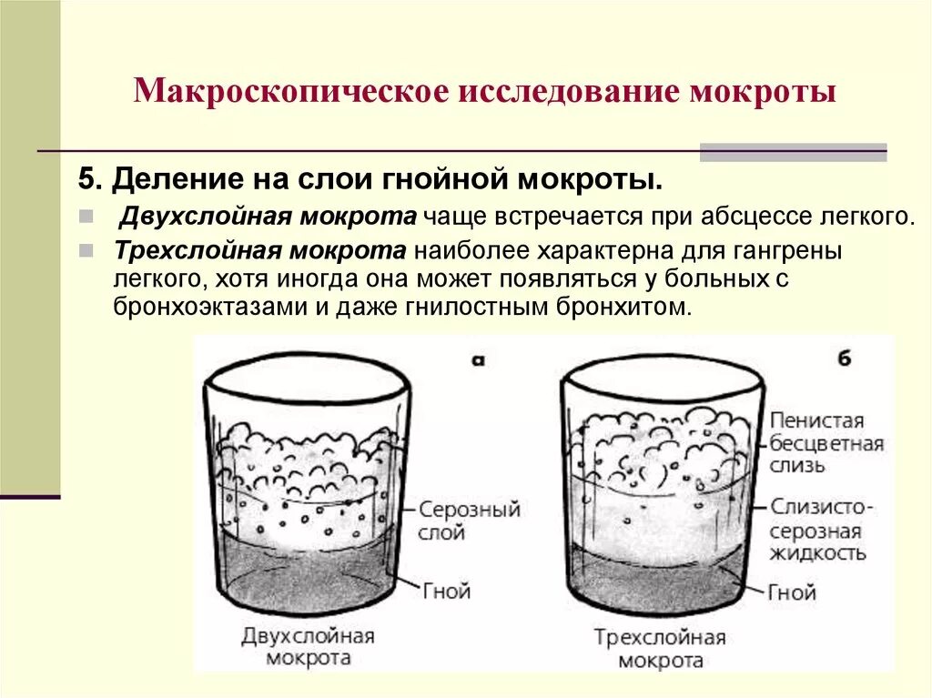 При гнойной мокроты противопоказан. Слои мокроты при абсцессе легкого. Исследование мокроты при гангрене. Трехслойная мокрота характерна для. Трехслойная мокрота при абсцессе.