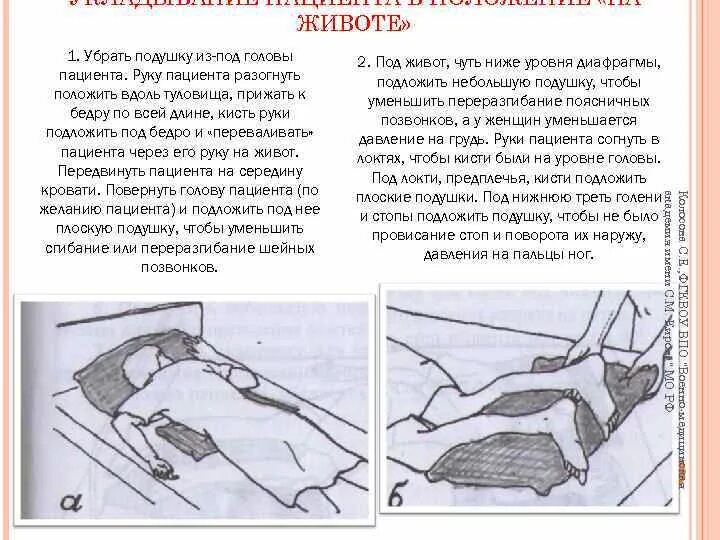 Операция лежа на животе. Размещение пациента в положение на животе. Перемещение пациента на живот алгоритм. Положение пациента лежа на животе. Положение лежа надивотк.