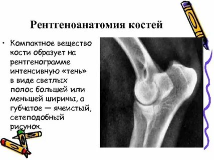 Приходи кости