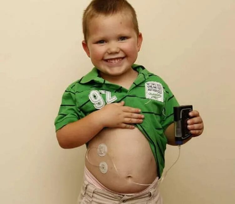 детский живот. живот подростка. жесткий живот у ребенка. болит животик у ребенка. жесткий живот у ребенка.