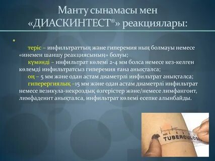 Что такое дст