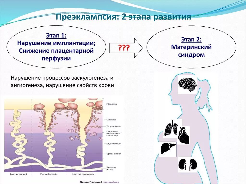 Преэклампсия беременных это. Преэклампсия при беременности причины. Преэклампсия причины механизмы развития. Преэклампсия причины. Механизм развития эклампсии.