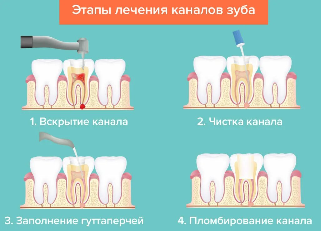 Сколько зубных каналов