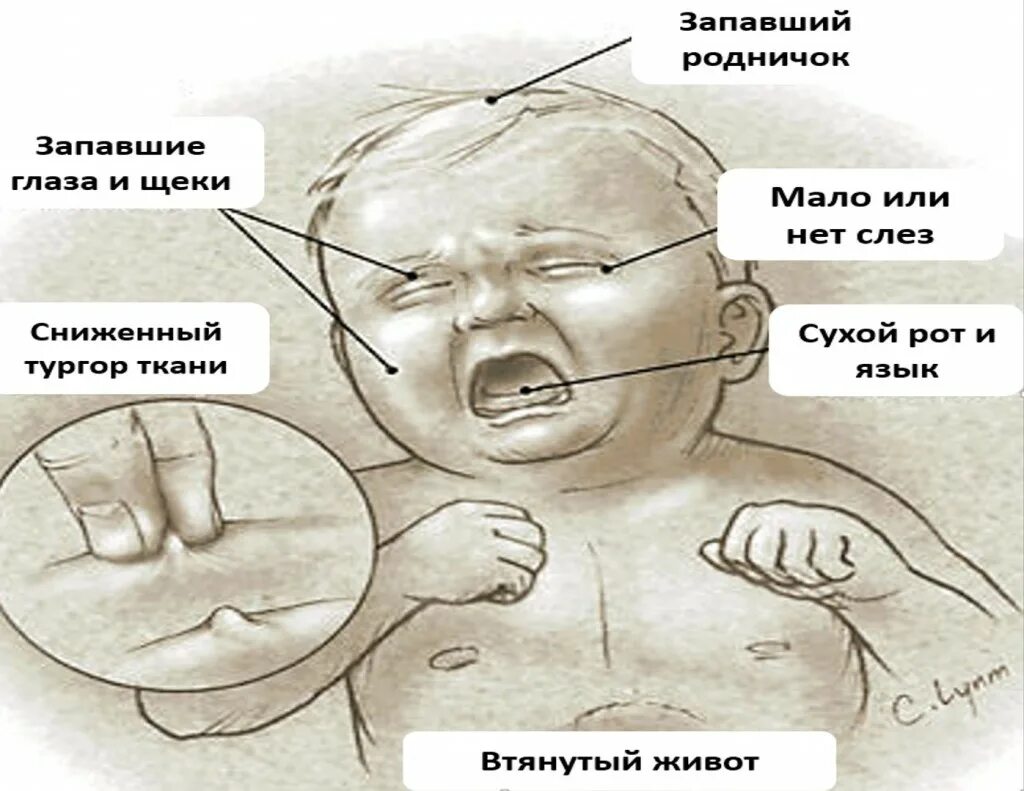 Почему головка не закрывается