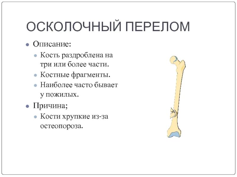 Крепкие кости. Какие бывают переломы костей. Хрупкие кости у пожилых. Почему костю назвали костей