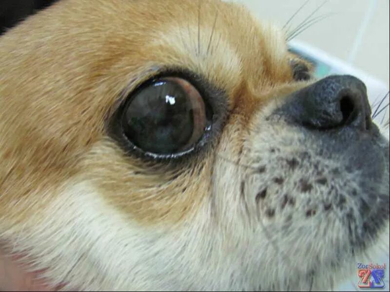 Ядерный склероз. Пресенильная катаракта. Ядерный склероз. Ядерный склероз. Ядерная бурая катаракта старческая.