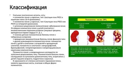 Множественные обеих почек