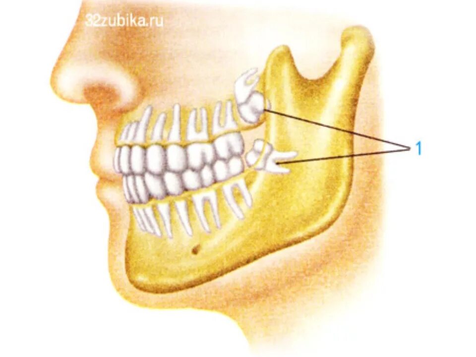 Строение челюсти и зуба мудрости. Ретированный зуб мудрости. Выдергивание зуба мудрости. У каких людей растут зубы мудрости. Где растет зуб мудрости.