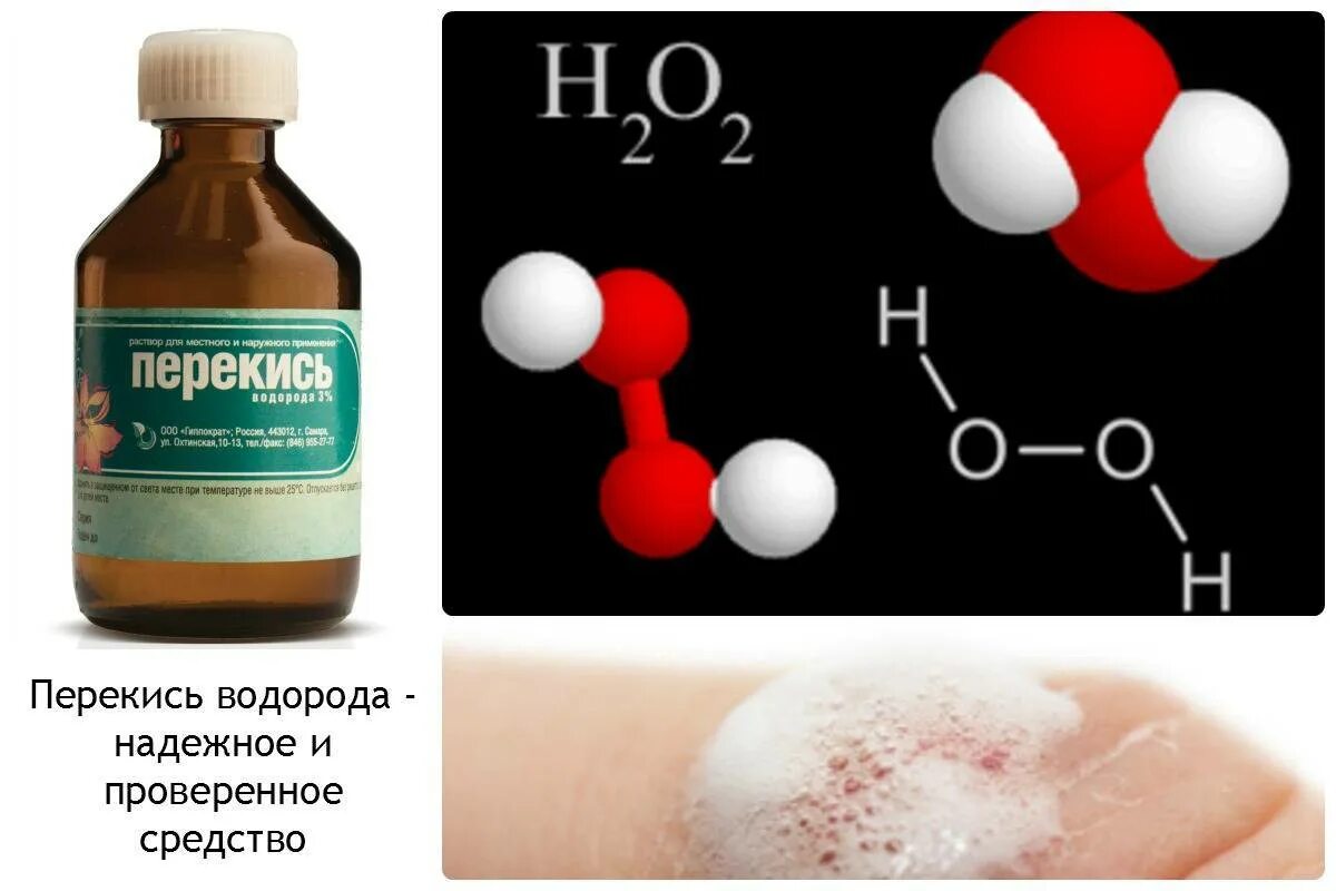 Перекись водорода относится к группе. Раствор перекиси водорода формула химическая. Химическая формула пероксида водорода. Раствор пероксида водорода формула. Перекись водорода формула химическая.