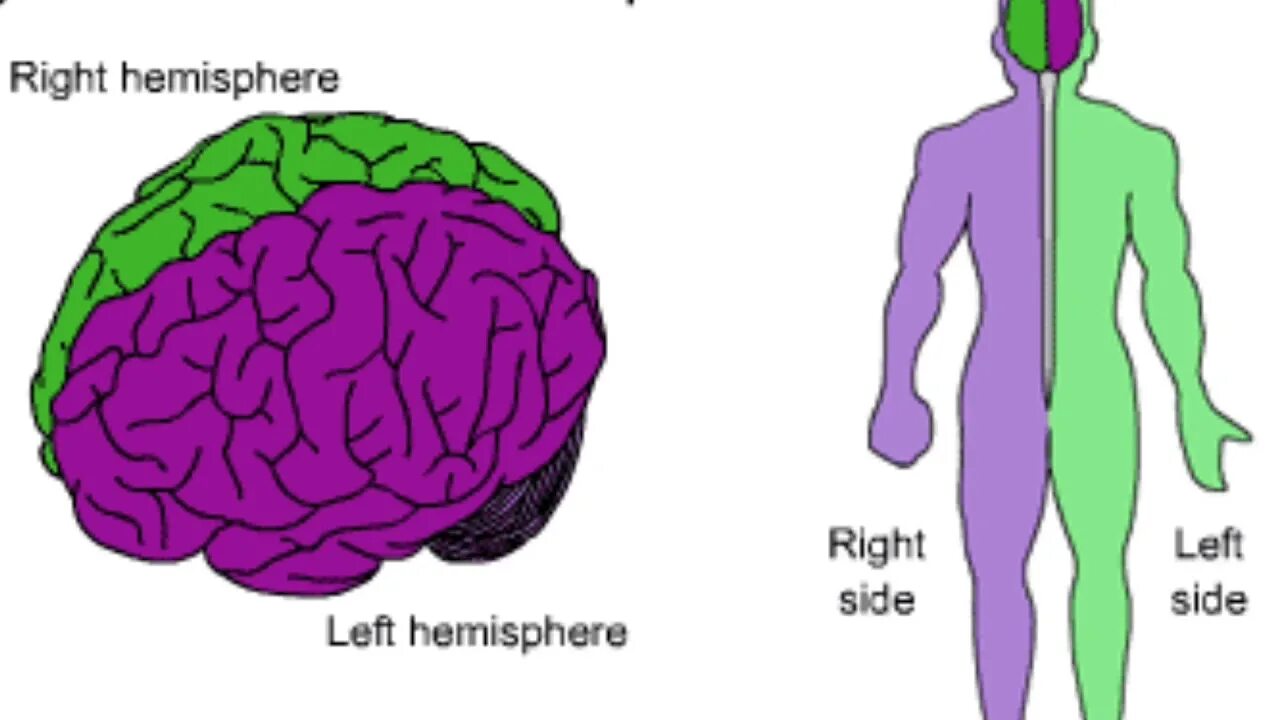Мозговые полушария. Левое полушарие правая сторона тела. Левое и правое полушарие мозга. Мозг и тело. Поражение правого полушария мозга