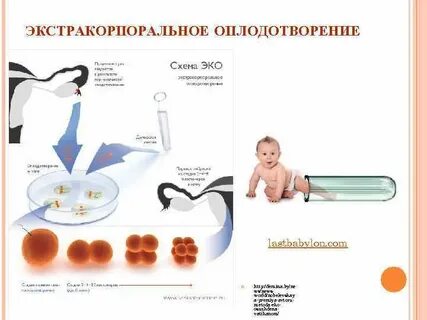 Методы искусственного оплодотворения