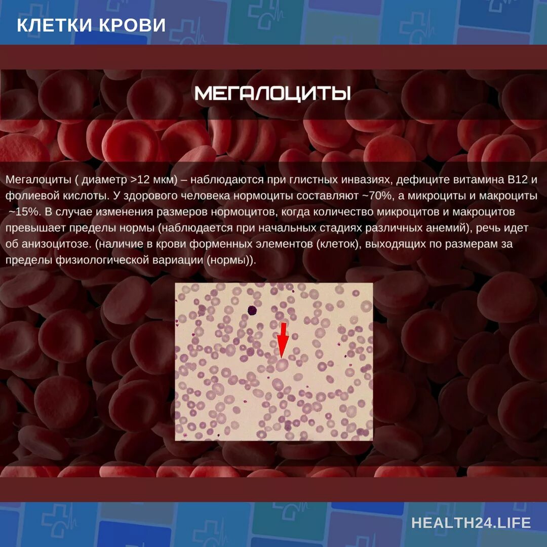 Микроциты повышены. Клетки крови. Нормальные клетки крови. Клетки крови эритроциты. Размеры клеток крови.