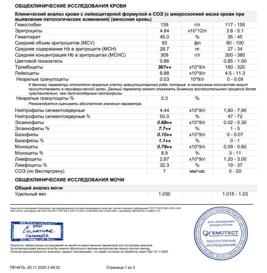 Анализ крови ребенок нормы эозинофилы. ОАК лейкоформула СОЭ расшифровка норма. Общий анализ крови норма таблица эозинофилы. Общий анализ крови без лейкоцитарной формулы.