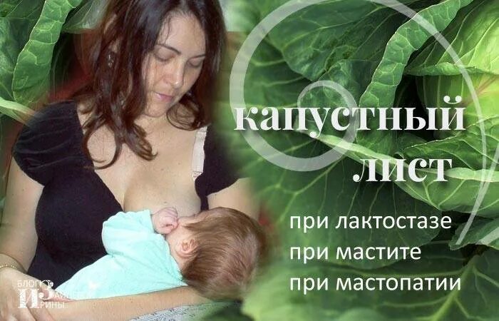 Лактостазы у кормящей мамы. Лист капусты при лактостазе. Капуста на грудь при гв. Капустный лист при лактостазе. Капустный лист на грудь.