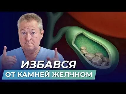 Желчный пузырь удаление камней отзывы