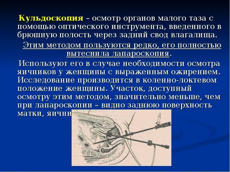 Гинекологические манипуляции. Пункция заднего свода инструменты. Игла для пункции заднего свода в гинекологии. Техника пункции заднего свода в гинекологии инструменты. Пункция заднего свода методика.