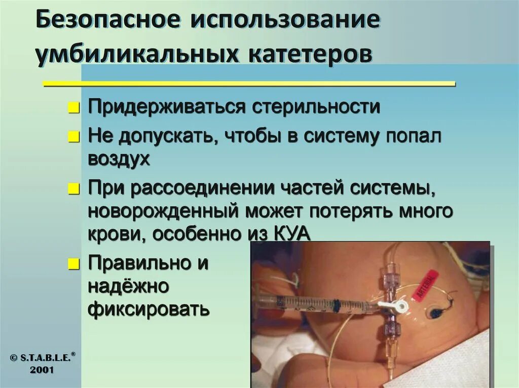 Катетер как пользоваться. Умбиликальный катетер у детей. умбиликальное введение это. умбиликальный катетер рентген. умбиликальный катетер у детей рентген.