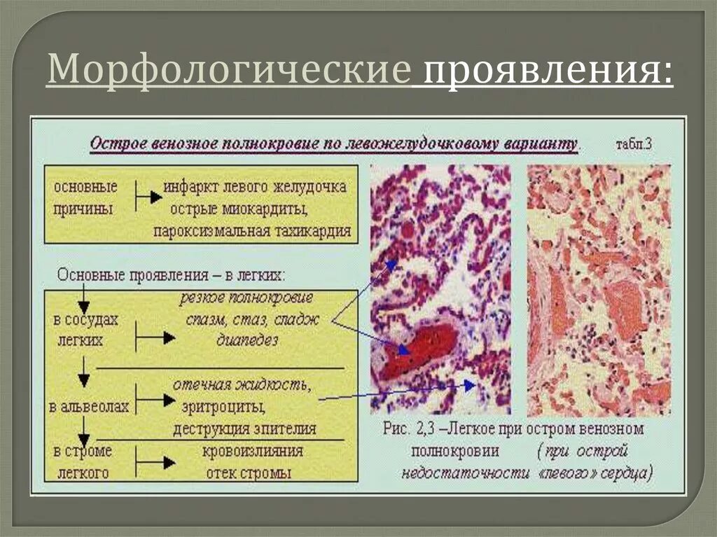 Морфологические изменения болезни. Морфология кровотечения патанатомия. Артериальная гиперемия венозная гиперемия. Морфология артериального полнокровия. Морфологические проявления это.