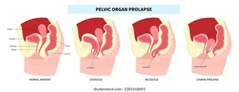 Skype-тан порно веб-жазбалар