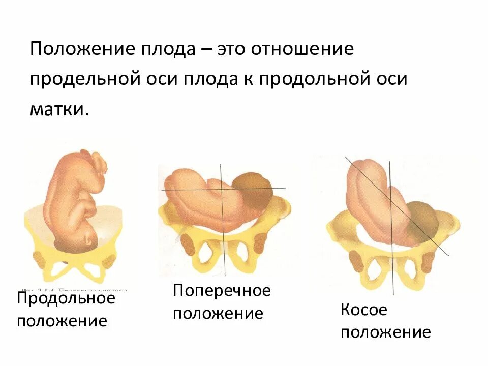 Как понять в каком положении ребенок