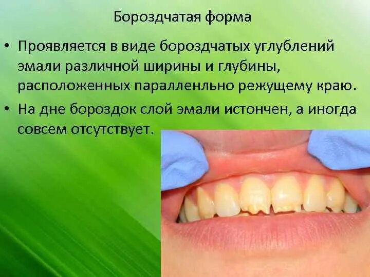 А как оно проявляется